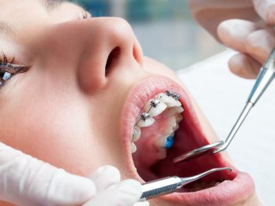 Imagem mostra pessoa sendo atendida pelo dentista