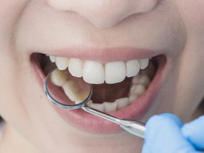 Imagem mostra mulher tendo dentes examinados em dentista