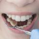 Imagem mostra mulher tendo dentes examinados em dentistas